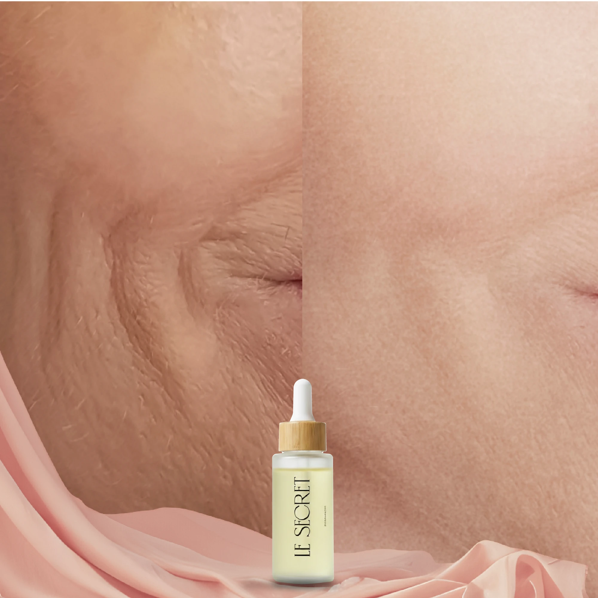 قبل وبعد - حالة 2