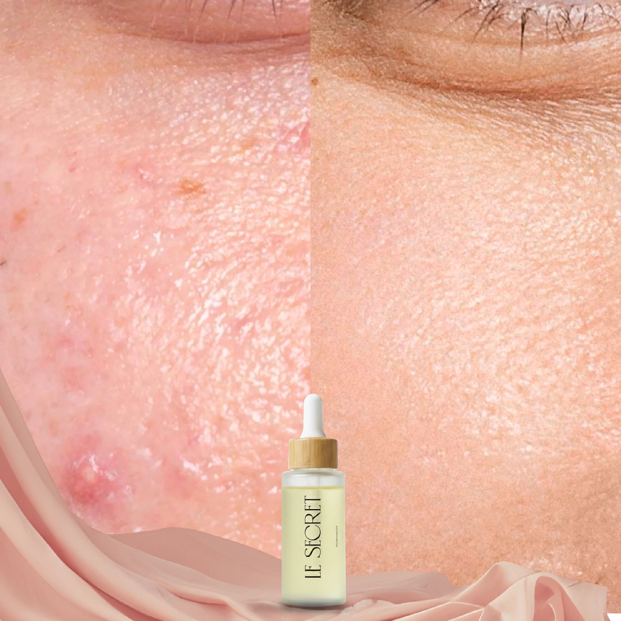 قبل وبعد - حالة 3