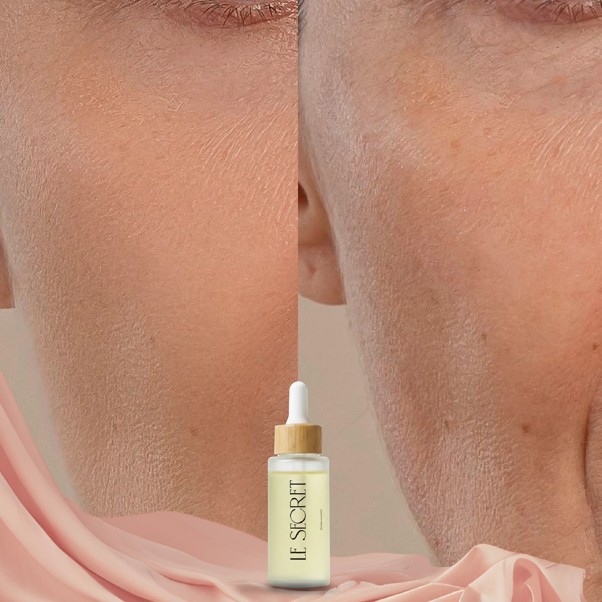 قبل وبعد - حالة 4