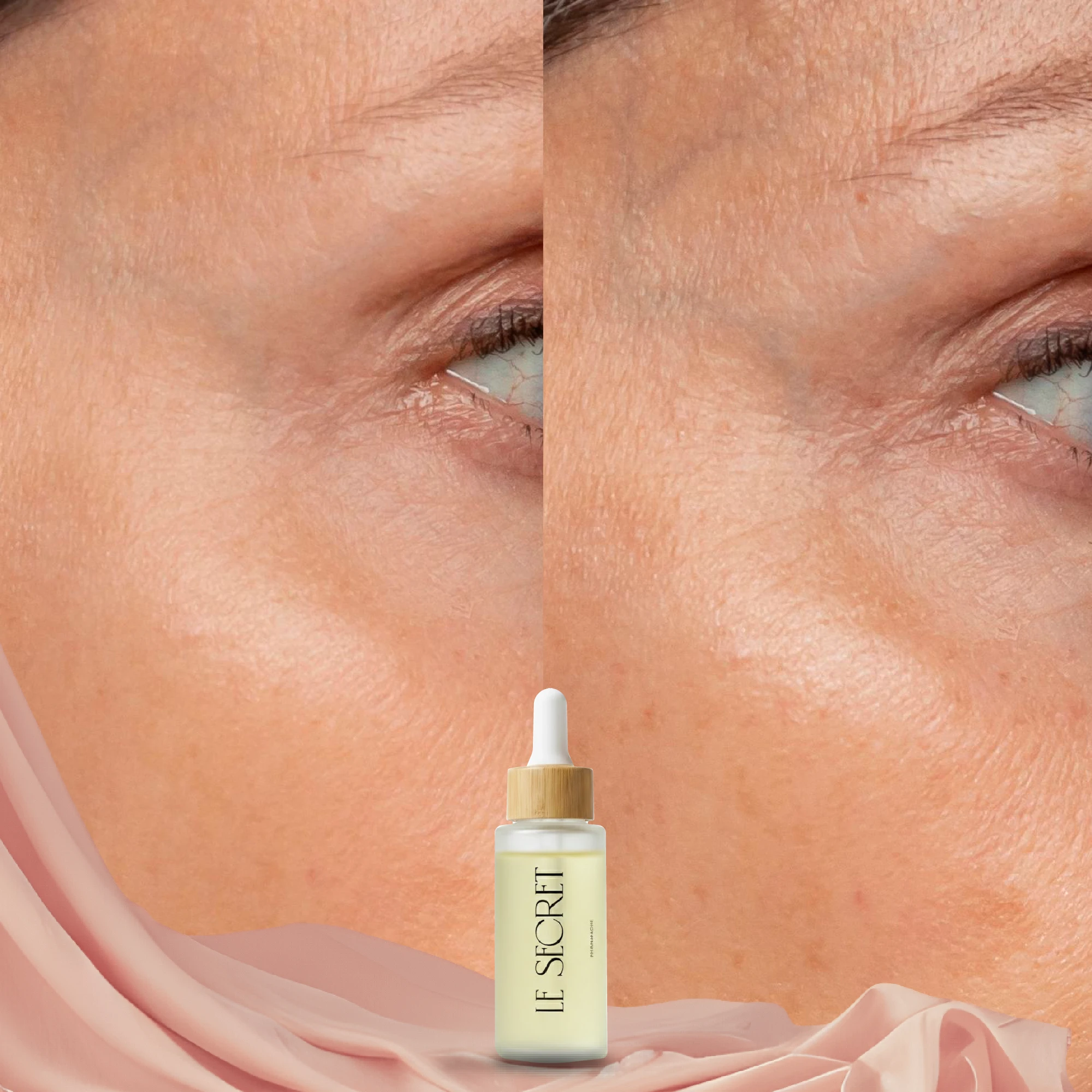 قبل وبعد - حالة 5